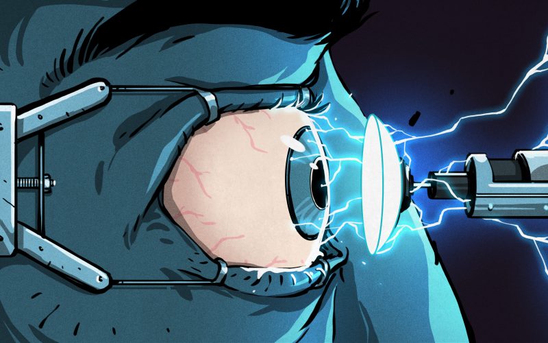reshaping-eyeballs-with-electricity,-no-lasers-or-cutting-required