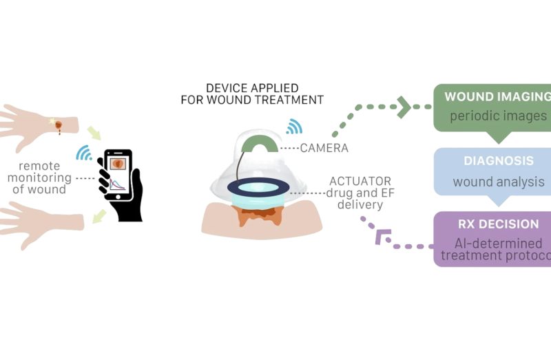 smart-bandage-leverages-ai-model-for-healing-purposes